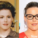 Kathleen Robertson Plastic Surgery Before and After Photos