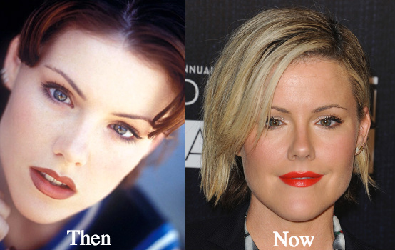 kathleen-robertson-plastic-surgery-before-and-after-photos