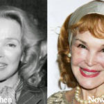 Kathryn Crosby Plastic Surgery Before and After Photos