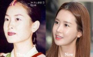 lee da hae plastic surgery Image 9