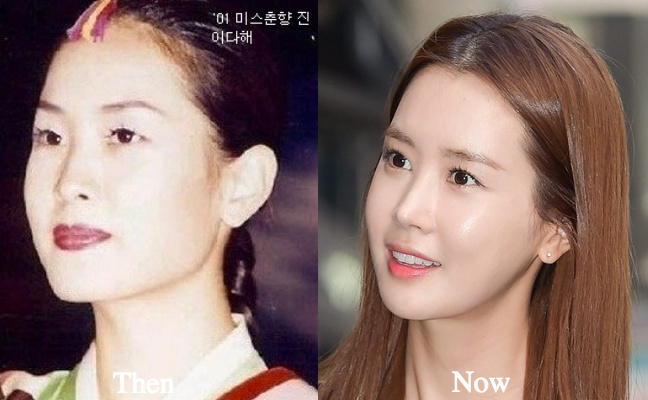 lee-da-hae-eyelid-surgery-before-and-after