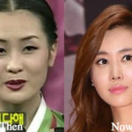 Lee Da Hae Plastic Surgery Before and After Photos