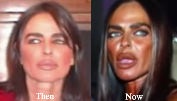 michaela-romaninin-before-and-after