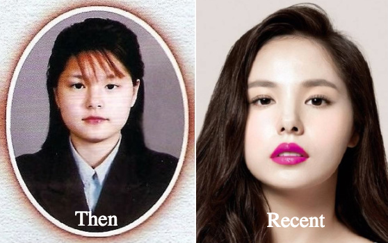 Min Hyo Rin Plastic Surgery Before and After Photos - Latest Plastic