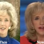 Rexella Van Impe Plastic Surgery Before and After Photos
