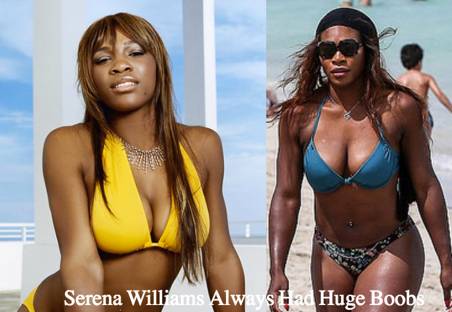 Photo Credit: (left) Walter Looss Jr Sports Illustrated, (right) Fameflynet UK Serena Williams Got a Boob Job? Are You NUTS?