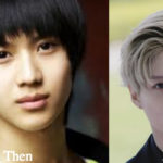 Taemin Plastic Surgery Before and After Photos