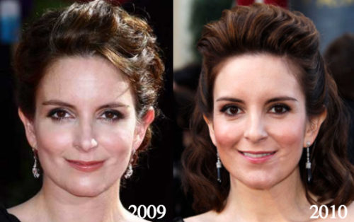 how did tina fey get her scar Image 5