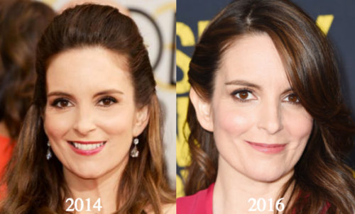 tina fey plastic surgery Image 5