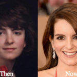 Tina Fey Plastic Surgery – Tina Fey Scar Before and After Photos
