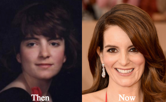 tina-fey-plastic-surgery-before-and-after-photos