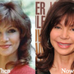 Victoria Principal Plastic Surgery Before and After Photos