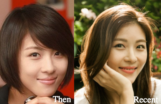 ha-ji-won-before-and-after