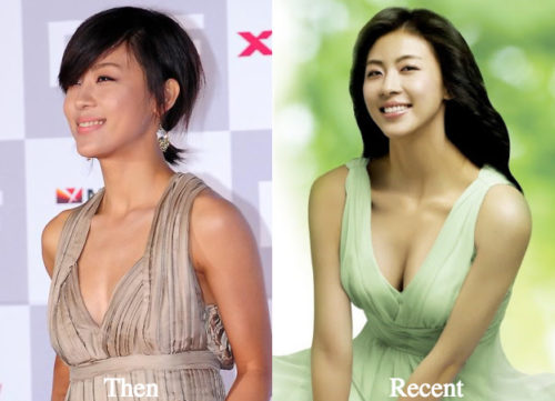 Ha Ji Won Plastic Surgery Before And After Photos Latest Plastic Surgery Gossip And News 