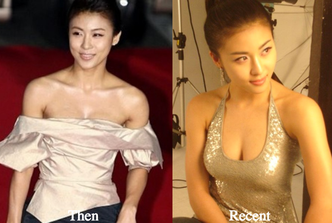ha-ji-won-breast-implants-surgery-rumors-before-and-after