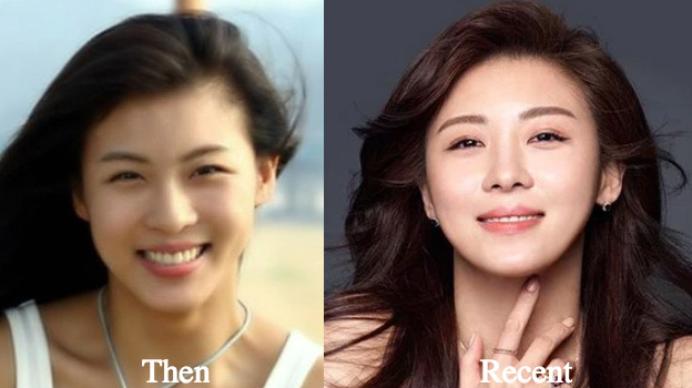 ha-ji-won-nose-job-rumors-before-and-after