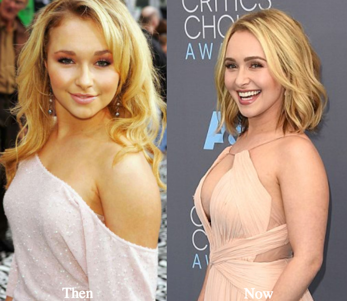 hayden-panettiere-boob-job-before-and-after