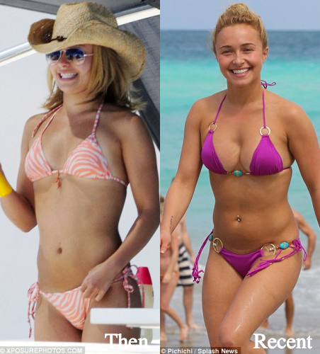 hayden-panettiere-plastic-surgery-boob-job-before-and-after-photos