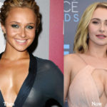 Hayden Panettiere Plastic Surgery Before and After Photos