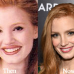 Jessica Chastain Plastic Surgery Before and After Photos