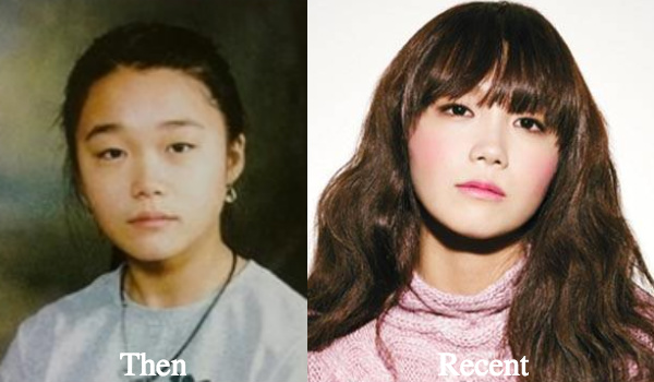 jung-eun-ji-nose-job-rumors-before-and-after