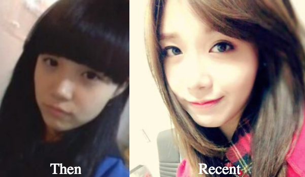jung-eun-ji-eyelid-surgery-before-and-after