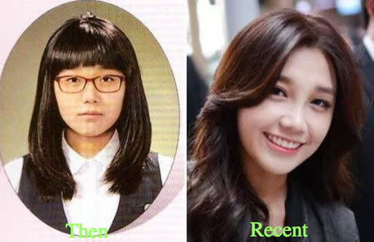 jung-eun-ji-plastic-surgery-rumors-before-and-after-photos
