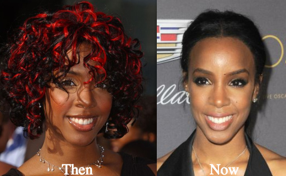 kelly-rowland-nose-job-before-and-after