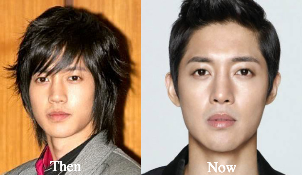 kim-hyun-joong-nose-job-rumors-before-and-after