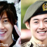 Kim Hyun Joong Plastic Surgery Before and After Photos