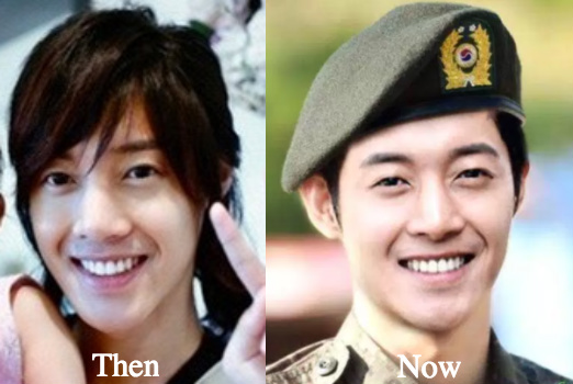 kim-hyun-joong-plastic-surgery-before-and-after-photos