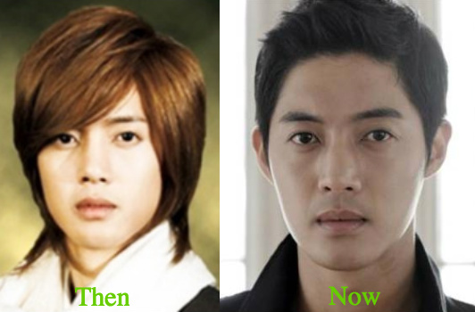 kim-hyun-joong-rhinoplasty-before-and-after
