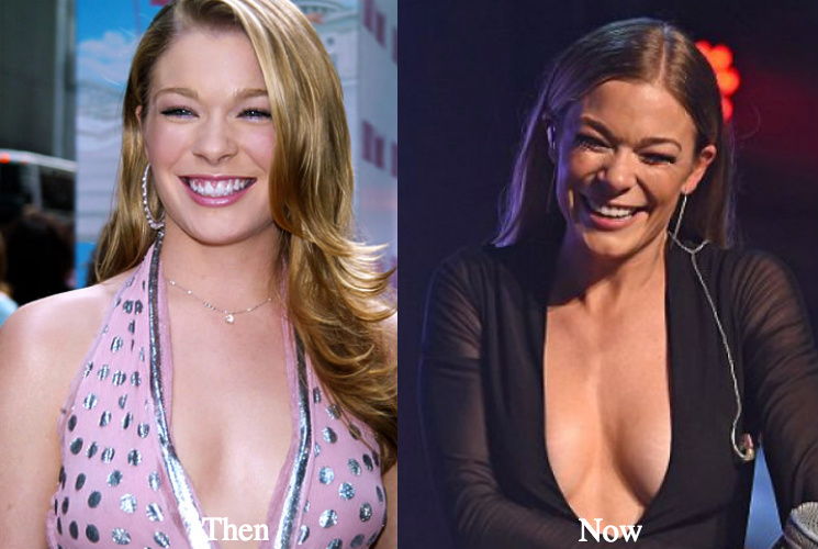 leann-rimes-boob-job-before-and-after