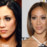 Melissa Gorga Nose Job Plastic Surgery Before and After Photos