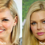 Sophie Monk Plastic Surgery Before and After Photos
