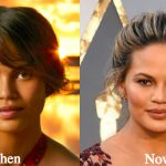 Chrissy Teigen Plastic Surgery Before and After Photos