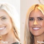 Christina El Moussa Plastic Surgery Rumors Before and After Comparison Photos