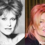 Deborra-Lee Furness Plastic Surgery Before and After Photos