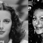 Hedy Lamarr Plastic Surgery Before and After Photos