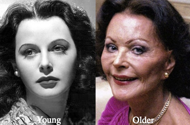 Hedy Lamarr before and after