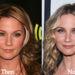 Jennifer Nettles Plastic Surgery Before and After Photos