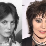 Joan Jett Plastic Surgery Before and After Photos