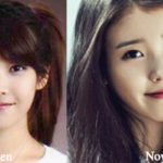 IU Plastic Surgery Before and After Photos