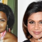 Mindy Kaling Plastic Surgery Before and After Photos