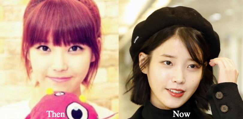 iu Plastic surgery before and after photos