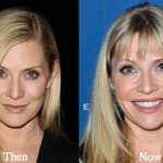 Emily Procter Plastic Surgery Before and After Photos