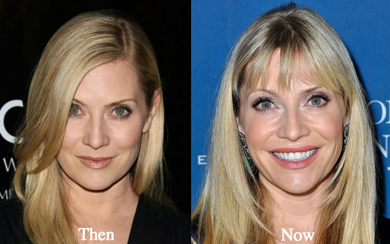 Emily Procter before and after plastic surgery photos
