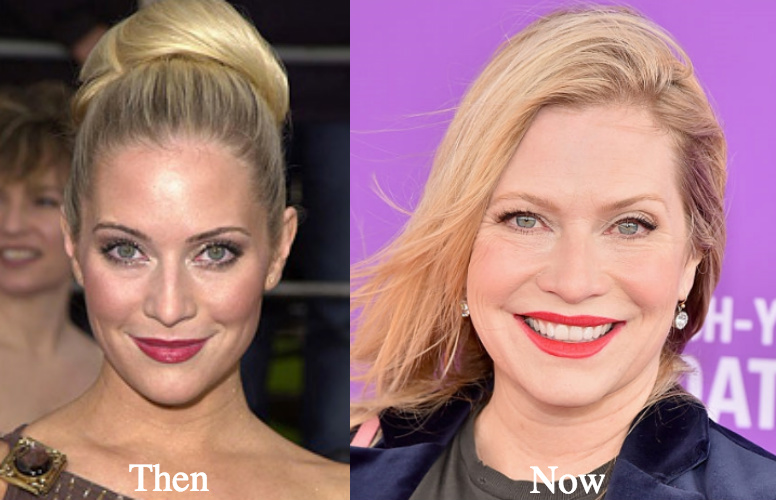Emily Procter botox before and after photos