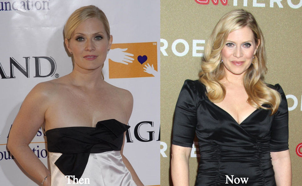 Emily Procter breast augmentation before and after