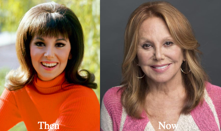 Marlo Thomas before and after